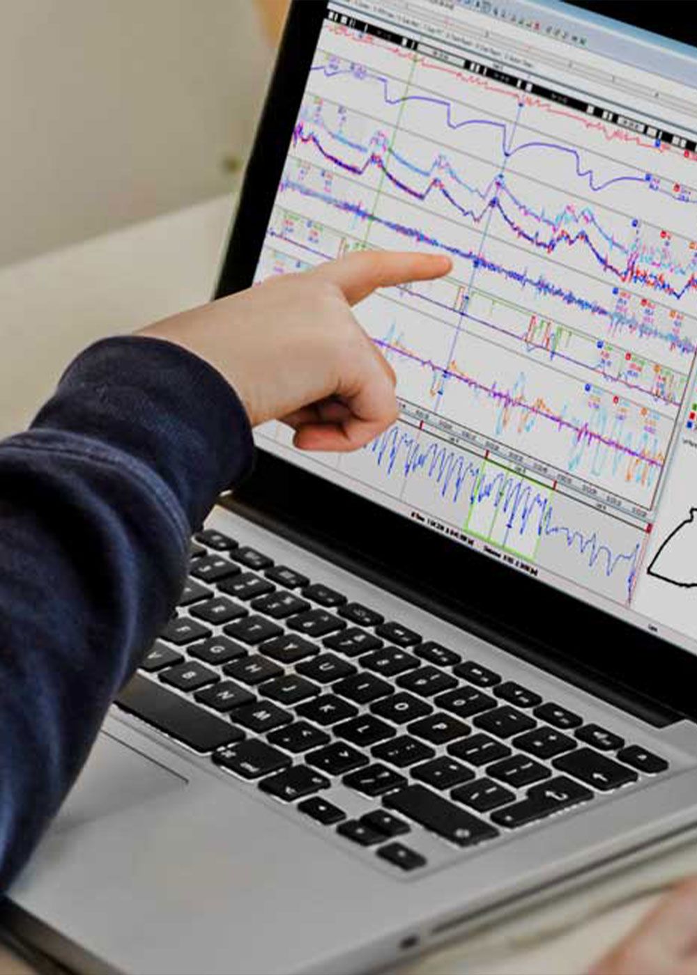 Hand pointing at telemetry traces on a laptop screen